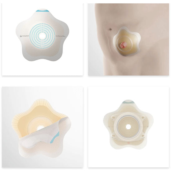 Coloplast 2-Piece SenSura Mio Click Convex Flip Barrier, Cut-to-fit, Stoma 3/8" - 2-9/16", Yellow (18530)