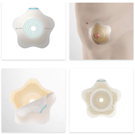 Coloplast 2-Piece SenSura Mio Click Convex Flip Barrier, Pre-cut, Stoma 2", X-Large, Yellow (18532)